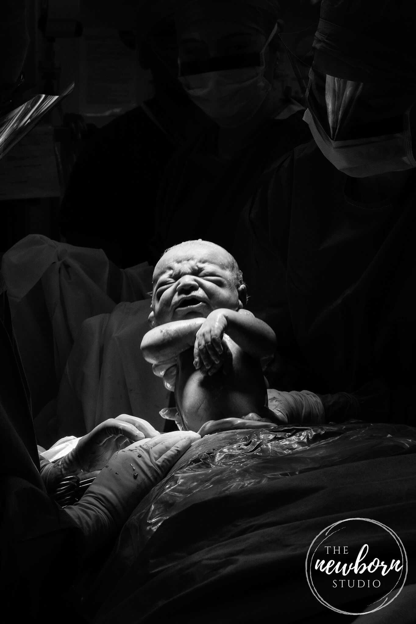 caesarian birth photography brisbane
