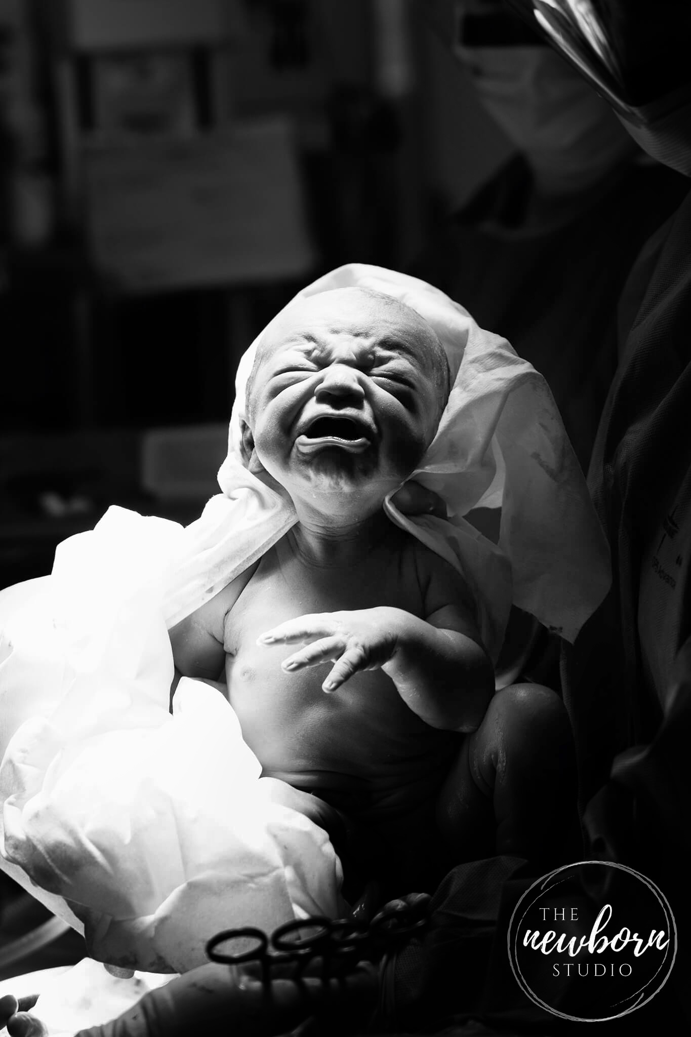 caesarian birth photography brisbane